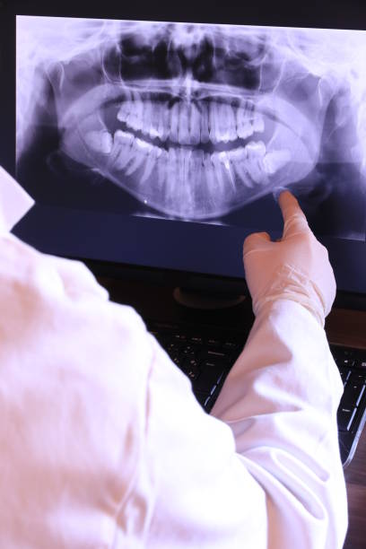 Best Emergency Wisdom Tooth Extraction in East Stroudsburg, PA